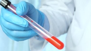 Laboratuvar teknisyeni elinde kan testi tüpü tutuyor. 