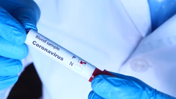 Laboratory technician hand holding blood test tube — Stock Video