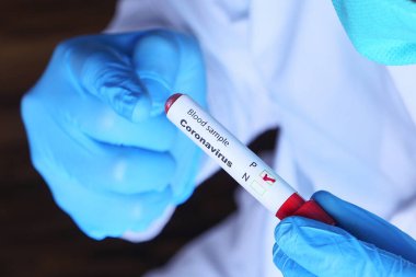 Kan testi tüpü tutan laboratuvar teknisyeninin elleri. 