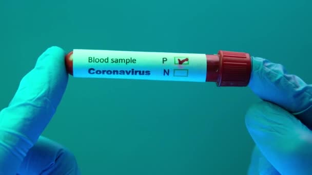 Hand in protective gloves holding blood test tube — Stock Video