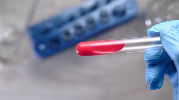 Laboratóriumi technikus kézben tartja a vérvizsgálati csövet — Stock videók