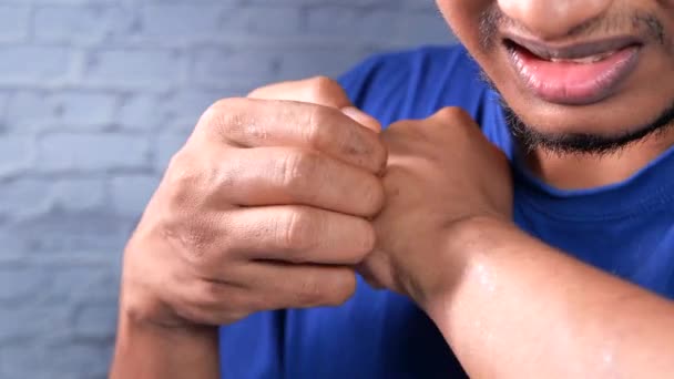 Manusia menderita gatal kulit, menutup. — Stok Video