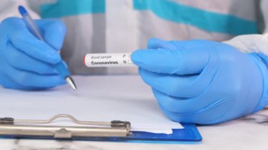 Laboratuvar teknisyeni elinde kan testi tüpü ve kağıda yazı tutuyor. 