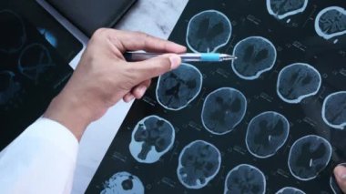Erkek doktor beklemede. Röntgen fotoğrafçılığını inceliyorum.