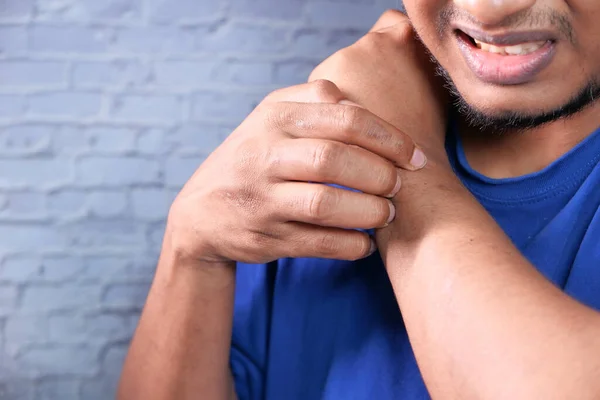 Hombre que sufre de picazón en la piel, de cerca. — Foto de Stock