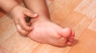  Çocuk kaşıntıdan muzdarip, yakından..