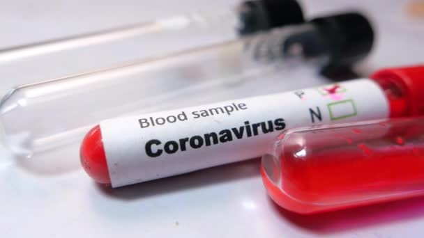 Close up of corona virus blood test tube on table — Stock Video