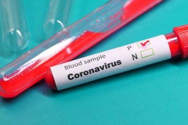 Corona virüsü kan test tüplerini kapatın. 