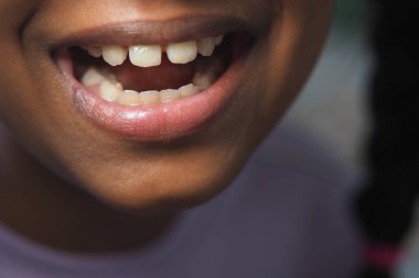 Küçük çocuk büyük bir gülümseme ile sevinç ifade eder, dişlerindeki boşlukları ortaya çıkarır..