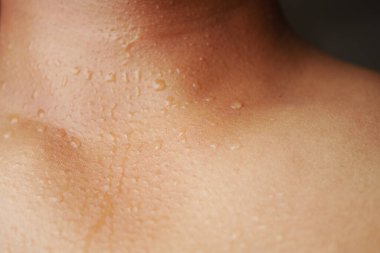 Sıcak ve nemli bir anda tenin yakın çekimi ter damlalarını gösteriyor..