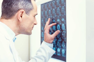 Konsantre Doktor bilgisayarlı tomografi taraması analiz