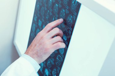 Erkek el MRI tarama dokunmadan suratında ölçekli
