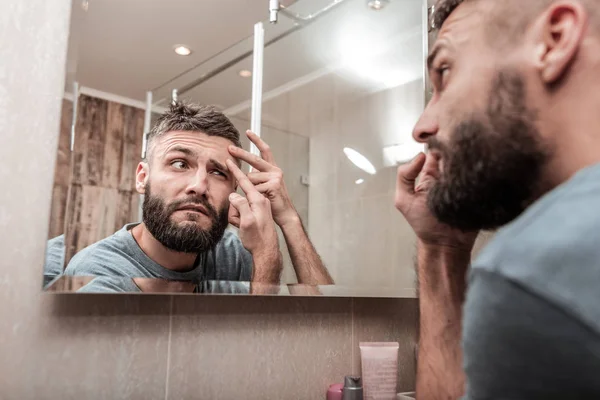 Acne at face. Bearded dark-haired man wearing grey shirt looking at acne on his face