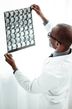 Erkek elinde bu holding X-ray resim kapat
