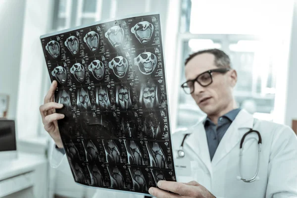 Confused doctor carrying x-ray photo of the bones
