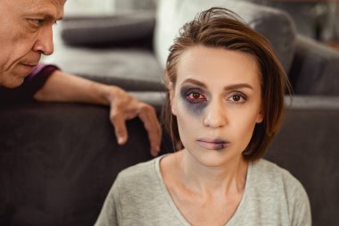 Katta oturan ve onun harap yüzünü gösterilen esmer Bayan