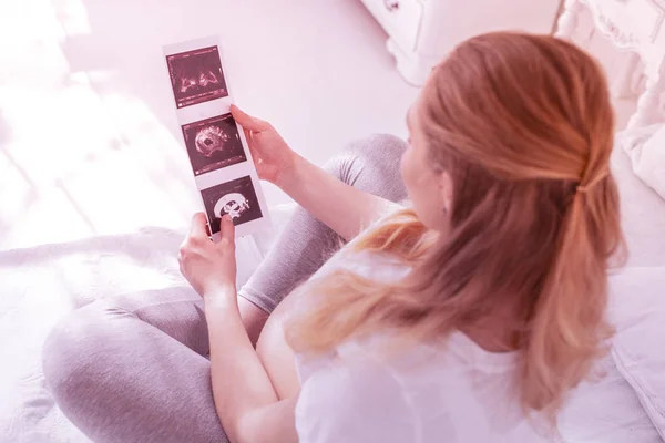 Ung långhåriga gravid kvinna i en vit t-shirt undersöker på röntgen bild — Stockfoto