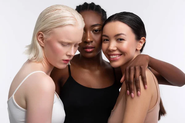 Women with different complexion feeling joyful hugging — Stock Photo, Image