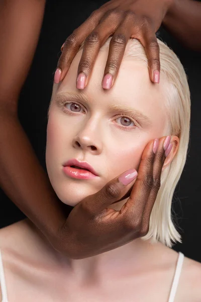 Afrikanisch-amerikanische Frau berührt Gesicht einer Frau mit weißer Haut — Stockfoto