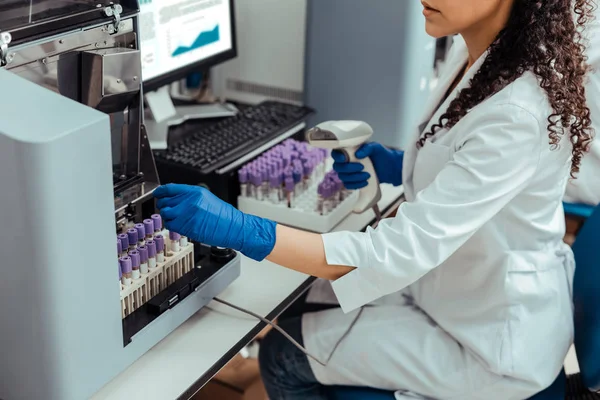 Primer plano de la mano femenina tomando muestras de sangre — Foto de Stock