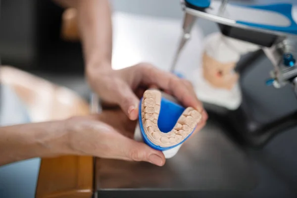 Gegoten model van patiënten tanden in handen van de tandarts. — Stockfoto
