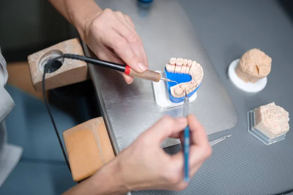 Handen van tandtechnicus uitlijnen van tanden op prothese. — Stockfoto