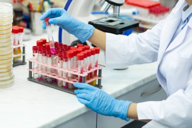 Ciddi bilim adamı Dna analizi yapacak