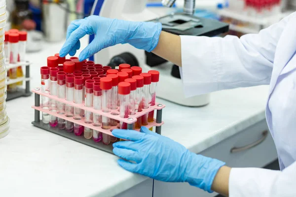 Close up of female hand that taking test tube — Stock Photo, Image