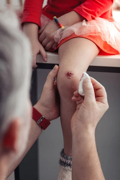 Foto focalizzata su mani maschili che si prendono cura di lesioni — Foto Stock