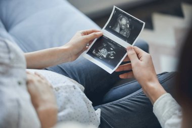 Ultrason taramasından sonra bebeğin ilk fotoğrafı.