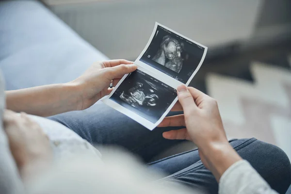 Ellerinde bebek tomografisi olan kadın ve erkeğin elleri. — Stok fotoğraf