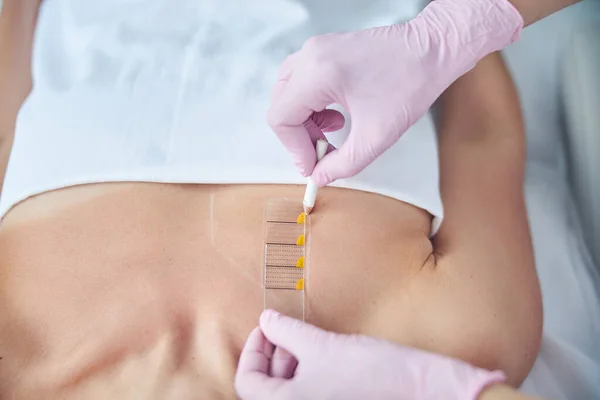 Therapie expert markering lage nek gebied voor hefprocedure — Stockfoto