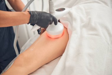 Kadın bacaklarında rahatlatıcı tedavi görüyor.