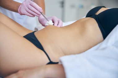 Tıbbi işlem sırasında steril gazlı bez kullanan bir cildiyeci.