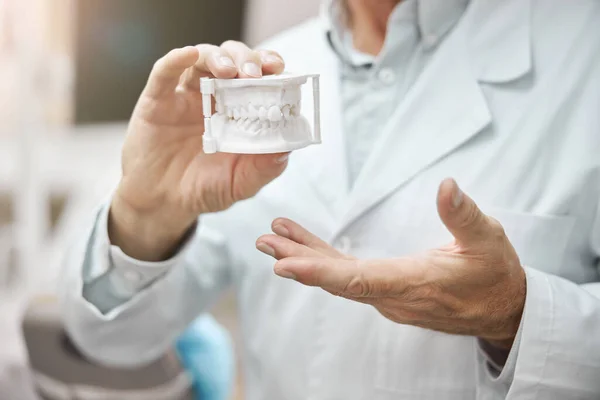 Demonstration of a white plaster mold of human jaws — Stock Photo, Image