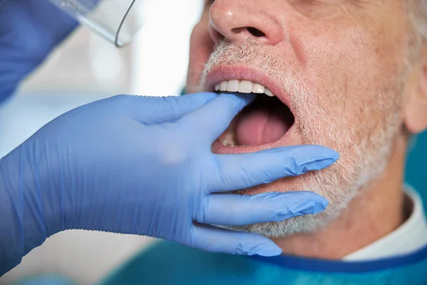 Hombre envejecido manteniendo la boca abierta para un dentista — Foto de Stock