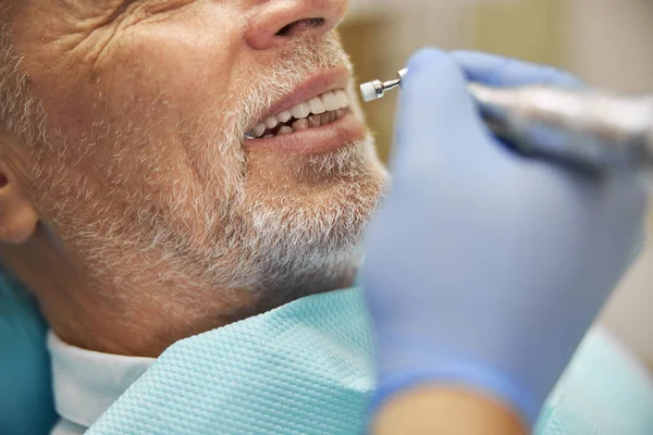 Queimador dentário em uso durante uma consulta odontológica — Fotografia de Stock