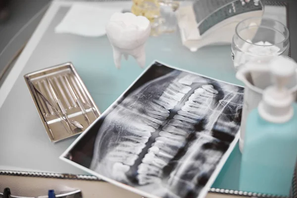 Tablero montado con herramientas y accesorios dentales — Foto de Stock