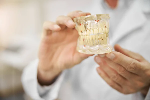 Точна копія зубів людини, які тримає стоматолог — стокове фото