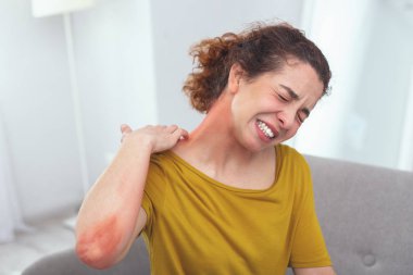 Young infected lady experiencing a spreading skin rash clipart