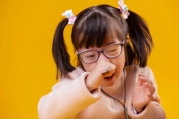 Extraordinary little girl with down syndrome having unusual face features — Stock Photo, Image