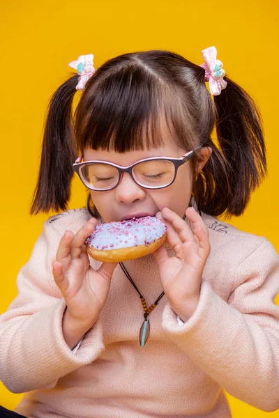 Extraordinary girl with unusual face features biting piece of blue donut — Stock Photo, Image