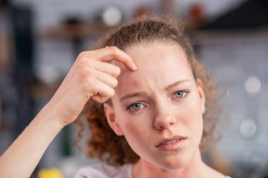 Distressed long-haired woman pointing on allergic spot clipart