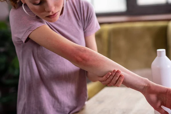 Attentive good-looking young girl being concerned about her irritated skin — Stock Photo, Image