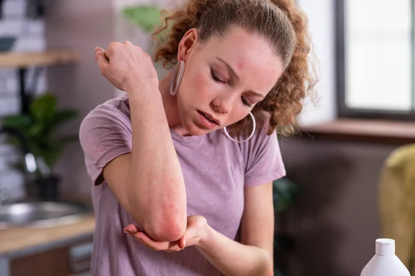 Mulher encaracolada atenta se preocupando com sua alergia — Fotografia de Stock