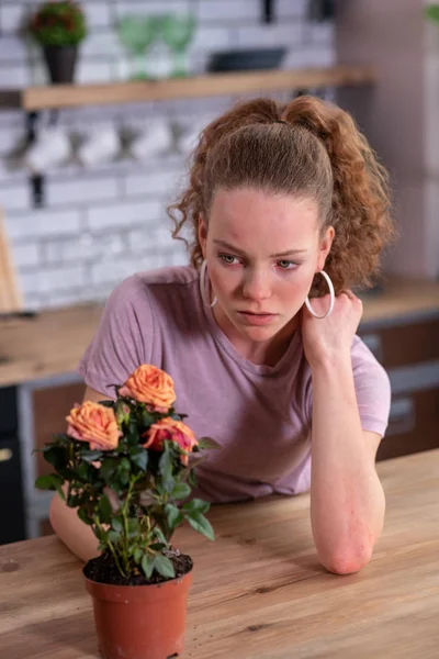 Gut aussehendes Mädchen mit hellen Haaren, das auf der ganzen Haut ausbricht — Stockfoto