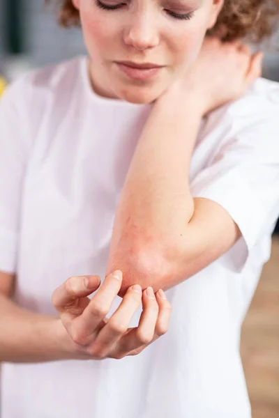 Förbryllat ung kvinna i vit t-shirt klåda hennes röda armbåge — Stockfoto
