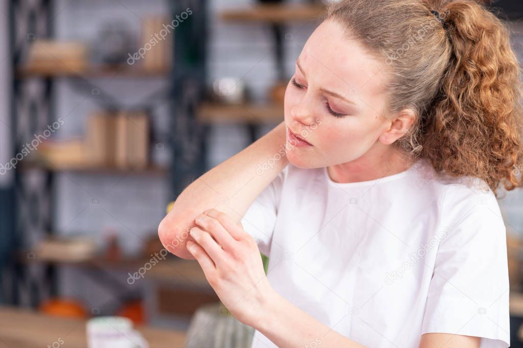Distressed unhappy young lady rubbing her spotted elbow