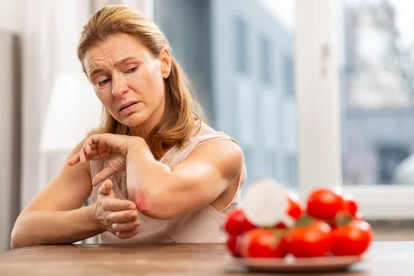 Mature woman with sensitive skin having allergy to some food — Stock Photo, Image