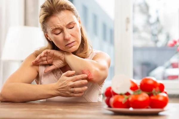 Woman having rash and scratches on elbow because of allergy — Stock Photo, Image